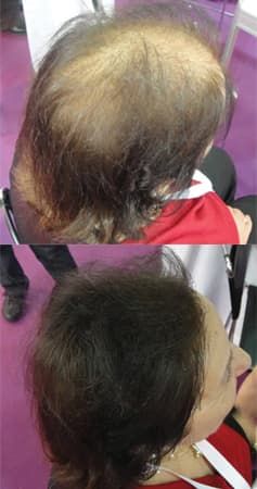 Before and after coverage of general thinning