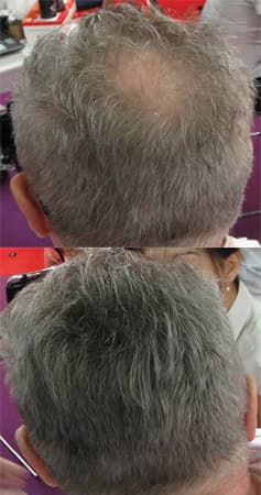 Before and after coverage of thinning grey hair